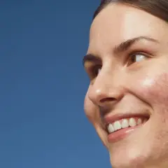 Sonrisa radiante de una joven con acné, buscando soluciones para quitar granos y lucir una piel sana.