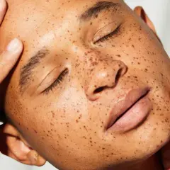 Rostro con pecas, piel radiante y manos acariciando la mejilla. El sebo natural de la piel, esencial para su salud.