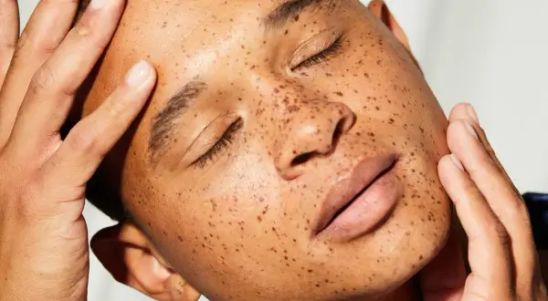 Rostro con pecas, piel radiante y manos acariciando la mejilla. El sebo natural de la piel, esencial para su salud.