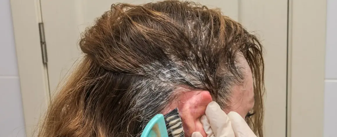 Aplicando producto para el cabello en la raíz. Si te manchas, así es como quitar el tinte de la piel.