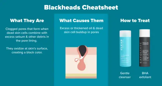 ¿Poros grandes? Afínalos - Guía experta para tu piel