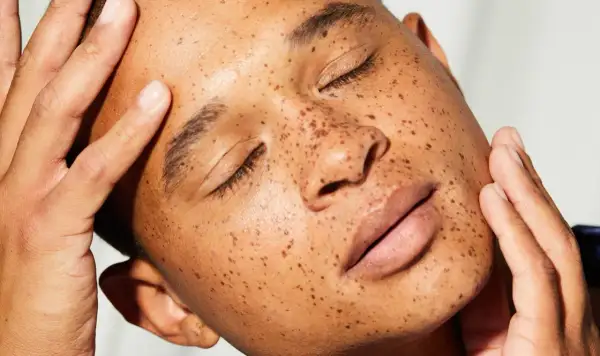 Rostro con pecas, piel radiante y manos acariciando la mejilla. El sebo natural de la piel, esencial para su salud.
