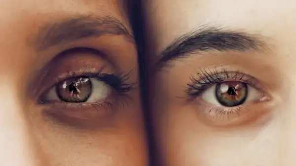 Dos ojos de cerca, uno con ojeras pigmentadas y el otro con piel clara. Reflejo de un fotógrafo en el iris.